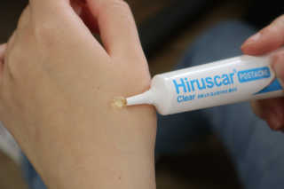 히루스카 포스트아크네 클리어,  히루스카 2021 다이어리 — 5점을 준 리뷰어가 2020년 12월 올린 사용 사진