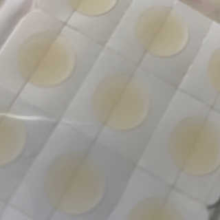 엘라밴드 하이드로 도트 스팟패치 12mm, 10mm — 5점을 준 리뷰어가 2020년 8월 올린 사용 사진