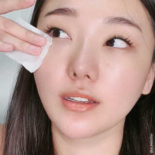 [헬로아이즈] 아이더마덱스 100ml + 순면솜120매 — 5점을 준 리뷰어가 2020년 10월 올린 사용 사진
