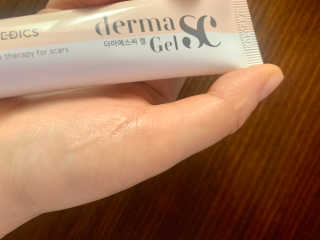 derma SC-Gel 더마에스씨 겔 20g — 4점을 준 리뷰어가 2020년 4월 올린 사용 사진