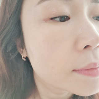 바이리뮤 에이지 홀딩 펩타톡스 앰플 — 5점을 준 리뷰어가 2020년 11월 올린 사용 사진