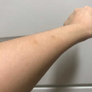 derma SC-Gel 더마에스씨 겔 20g — 4점을 준 리뷰어가 2020년 5월 올린 사용 사진