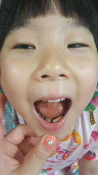 비타맘 키즈플러스업 성장기 어린이 멀티비타민미네랄 120정 — 5점을 준 리뷰어가 2020년 5월 올린 사용 사진