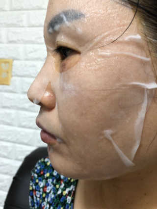 비피도랩 프로클리닉 폴루션에이징 프로텍트 마스크 — 5점을 준 리뷰어가 2020년 8월 올린 사용 사진