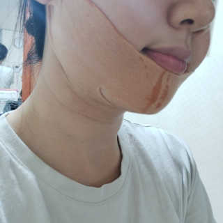 아이디플라코스메틱 아이디 페이스핏 마이너스 밴드 — 5점을 준 리뷰어가 2020년 4월 올린 사용 사진