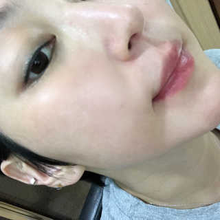 바이오믹 센시메틱 수딩 토너 — 5점을 준 리뷰어가 2020년 7월 올린 사용 사진