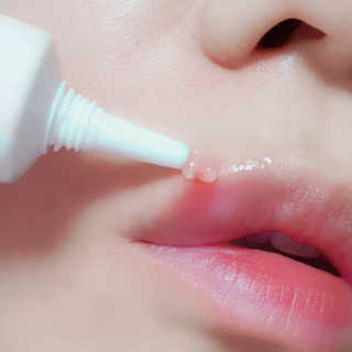 derma SC-Gel 더마에스씨 겔 20g — 5점을 준 리뷰어가 2020년 5월 올린 사용 사진