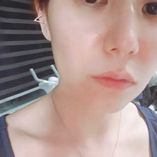 바베 BABE 바베 프로테오글리칸 F+F 앰플 솔루션 — 5점을 준 리뷰어가 2020년 6월 올린 사용 사진