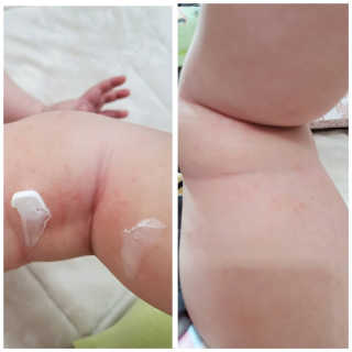 아토스탠다드 베이비크림 — 5점을 준 리뷰어가 2020년 11월 올린 사용 사진