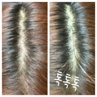 [크리산]  모근.모발강화 악티프 토닉 — 5점을 준 리뷰어가 2020년 6월 올린 사용 사진