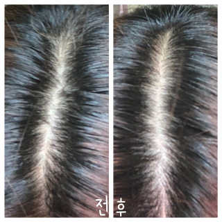 멈칫 향기좋은 약산성 샴푸, 단백질 퀵트리트먼트 택1 — 5점을 준 리뷰어가 2020년 6월 올린 사용 사진