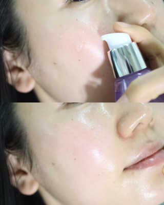 [후르디아] 72시간 보습- 블루베리 세럼+수분크림 세트 — 5점을 준 리뷰어가 2020년 4월 올린 사용 사진
