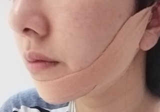 아이디플라코스메틱 아이디 페이스핏 마이너스 밴드 — 5점을 준 리뷰어가 2020년 4월 올린 사용 사진