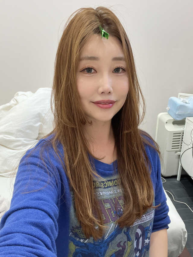 스케덤 시카 리프팅밴드 리뷰 사진