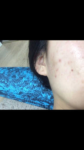 La Theorie Hydrating Ingredients | 하이드레이팅 인그레이디언츠 — 5점을 준 리뷰어가 2020년 5월 올린 사용 사진