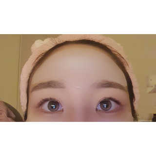 아이디플라코스메틱 아이디 페이스핏 플러스 패치 v2 — 5점을 준 리뷰어가 2020년 12월 올린 사용 사진