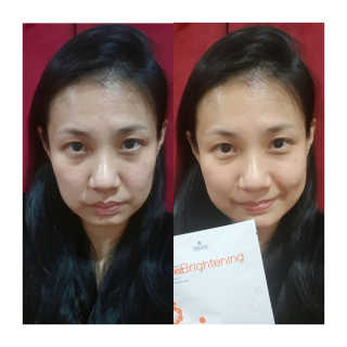 트리티스 [Treatis] Facial Sheet Mask — 5점을 준 리뷰어가 2020년 12월 올린 사용 사진