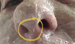 메디타임 포어 블랙 헤드 원샷 팩 — 5점을 준 리뷰어가 2020년 7월 올린 사용 사진
