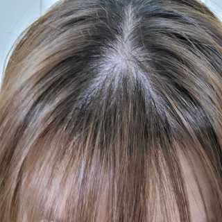 달리프 클로렐라 베러 루트 헤어토닉 100ml — 5점을 준 리뷰어가 2020년 11월 올린 사용 사진