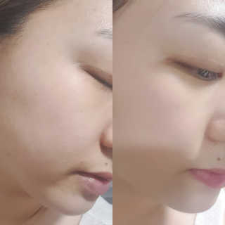 메디필 에스테 더마 유산균 콜라겐 클리어 — 5점을 준 리뷰어가 2020년 5월 올린 사용 사진
