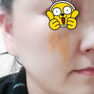 메디페르 루테인앰플 10ml 4개 — 4점을 준 리뷰어가 2020년 4월 올린 사용 사진