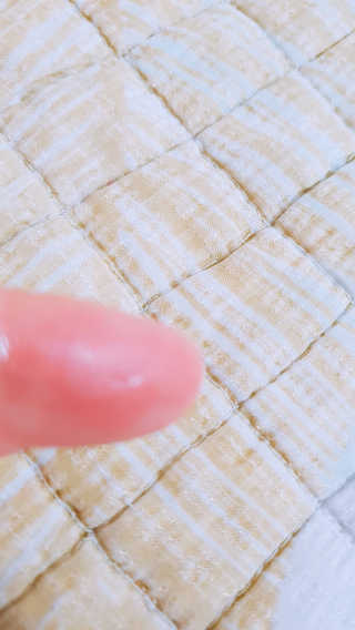 derma SC-Gel 더마에스씨 겔 20g — 5점을 준 리뷰어가 2020년 5월 올린 사용 사진