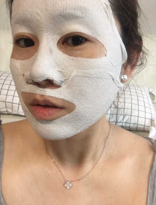 아이디플라코스메틱 페이스핏 플라스터 마스크 — 4.5점을 준 리뷰어가 2020년 5월 올린 사용 사진