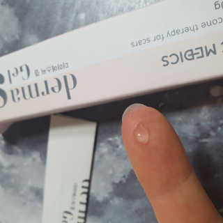 derma SC-Gel 더마에스씨 겔 20g — 5점을 준 리뷰어가 2020년 4월 올린 사용 사진