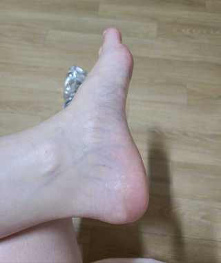 리더스코스메틱 리더스 프로 포커싱 풋 너리싱 마스크/5매 — 5점을 준 리뷰어가 2020년 9월 올린 사용 사진