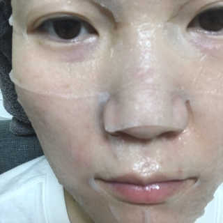 리더스코스메틱 리더스 메디유 아미노 모이스처 마스크 — 5점을 준 리뷰어가 2020년 5월 올린 사용 사진