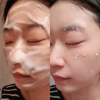 파시랩 그린 플러스 락토 버블 필링 — 5점을 준 리뷰어가 2020년 10월 올린 사용 사진