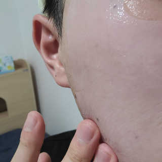 이너풀 하이 모이스처라이징 바이오셀룰로오스 마스크 — 5점을 준 리뷰어가 2020년 8월 올린 사용 사진