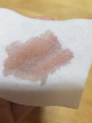 메디필 블랙 허니 세범 익스트렉터 — 1점을 준 리뷰어가 2020년 6월 올린 사용 사진