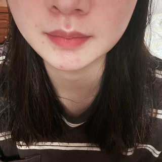 Dr다룸 릴리프 앰플 — 4점을 준 리뷰어가 2020년 6월 올린 사용 사진