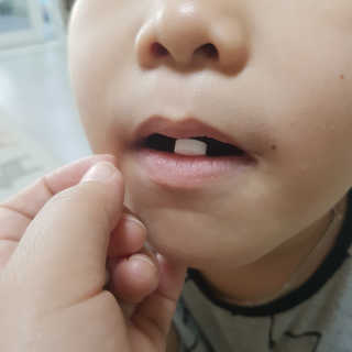동성제약_바이오가이아_아토24 바이오가이아 츄어블정 30정 — 5점을 준 리뷰어가 2020년 5월 올린 사용 사진