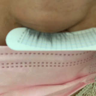 닥터존스킨 눈썹자라 — 3점을 준 리뷰어가 2020년 8월 올린 사용 사진