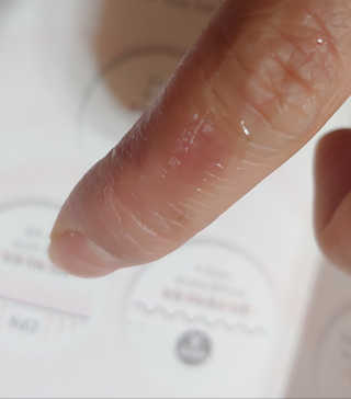 derma SC-Gel 더마에스씨 겔 20g — 5점을 준 리뷰어가 2020년 5월 올린 사용 사진