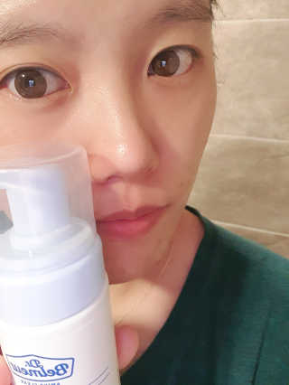네이처컬렉션 닥터벨머 아미노클리어 아크네 버블 폼 — 5점을 준 리뷰어가 2020년 6월 올린 사용 사진