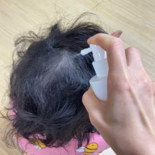 리더스코스메틱 리더스 헤어 라피 헤어 로스 컨트롤 토닉 — 4.5점을 준 리뷰어가 2020년 12월 올린 사용 사진