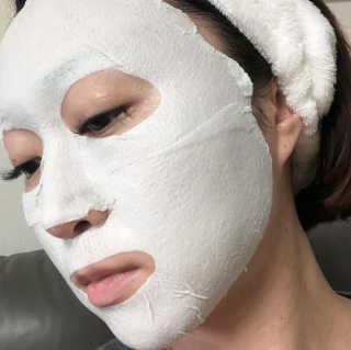 아이디플라코스메틱 페이스핏 플라스터 마스크 — 4.5점을 준 리뷰어가 2020년 7월 올린 사용 사진