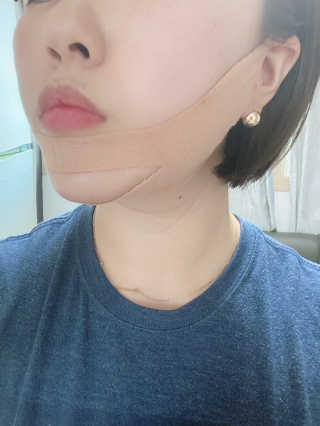 아이디플라코스메틱 아이디 페이스핏 마이너스 밴드 — 5점을 준 리뷰어가 2020년 5월 올린 사용 사진