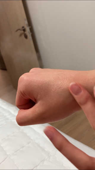 메디페르 [ 1+1 ] 루테인앰플세트 1개 + 루테인크림 50ml 1개 — 5점을 준 리뷰어가 2020년 12월 올린 사용 사진