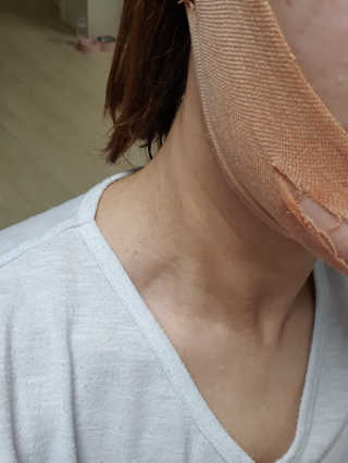 아이디플라코스메틱 아이디 페이스핏 마이너스 밴드 v2 — 4점을 준 리뷰어가 2020년 12월 올린 사용 사진