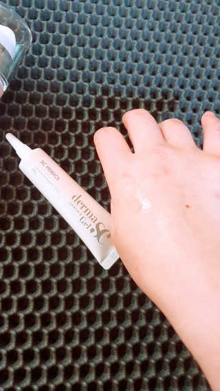 derma SC-Gel 더마에스씨 겔 20g — 5점을 준 리뷰어가 2020년 4월 올린 사용 사진